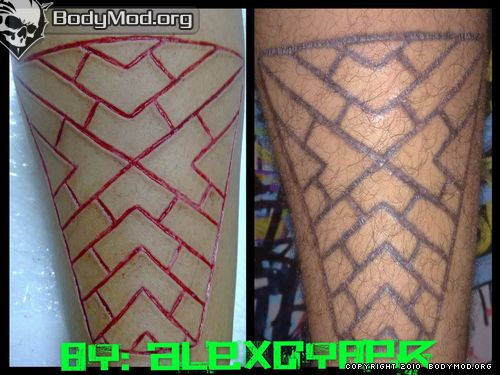 Back Scarification Scarification Before And After