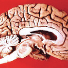 Thumb_140_brain_courtesy