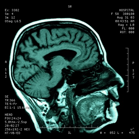 Functional Medicine and Functional Neurology for the support of chronic disease process and improved systemic health