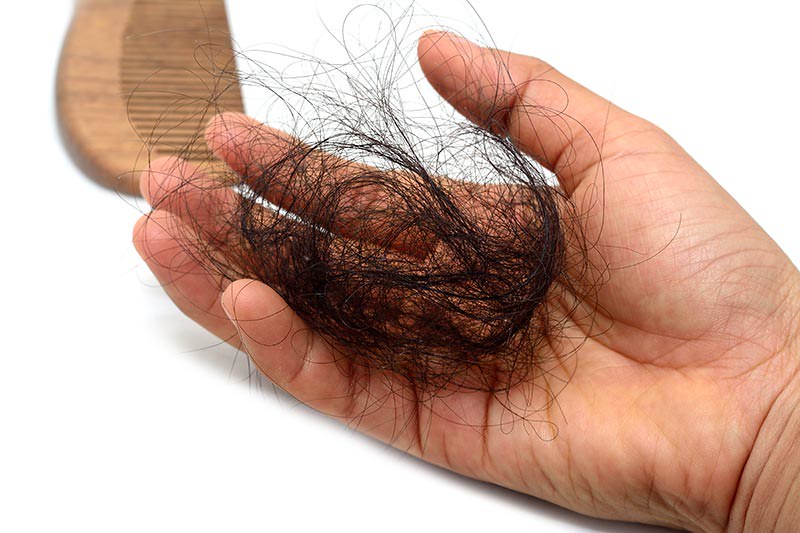 Queda de cabelo