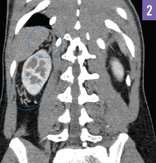 Coronal view CT scan