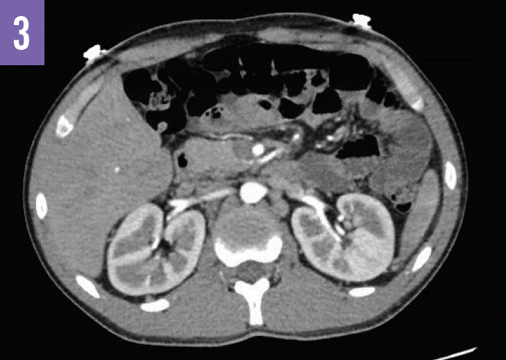 CT scan with contrast
