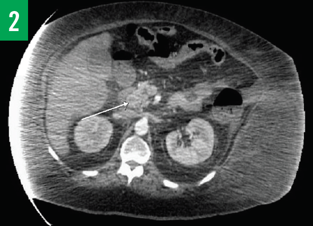 CT scan figure 2