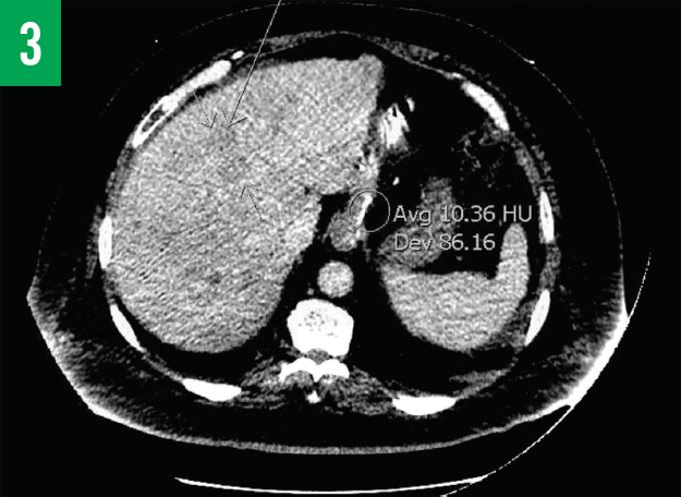 CT scan figure 3