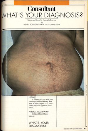 Consultant ADPKD October 1990