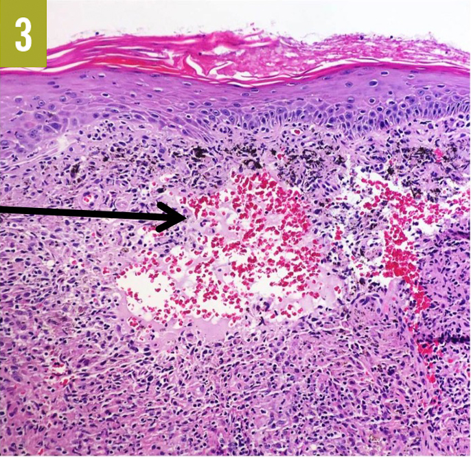 mycobacterial organisms