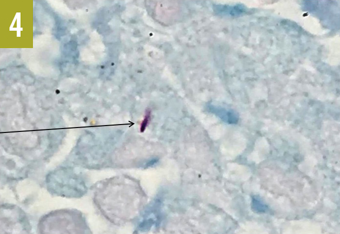 mycobacteria organism