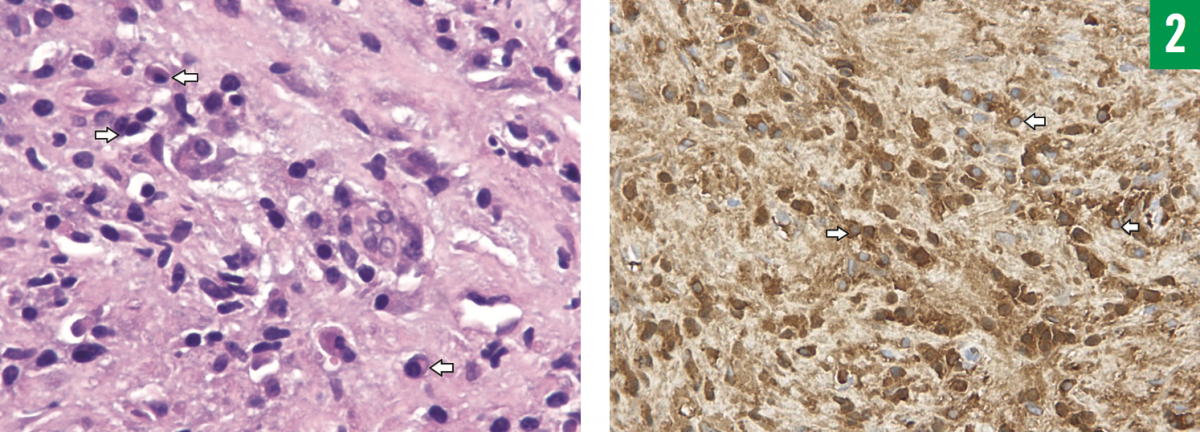  hematoxylin-eosin stain 