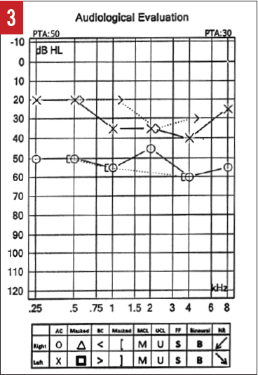 Figure 3 audiological evaluation