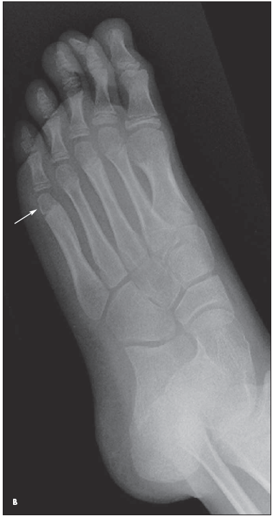 foot X-ray 