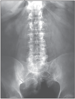 radiograph of kidneys