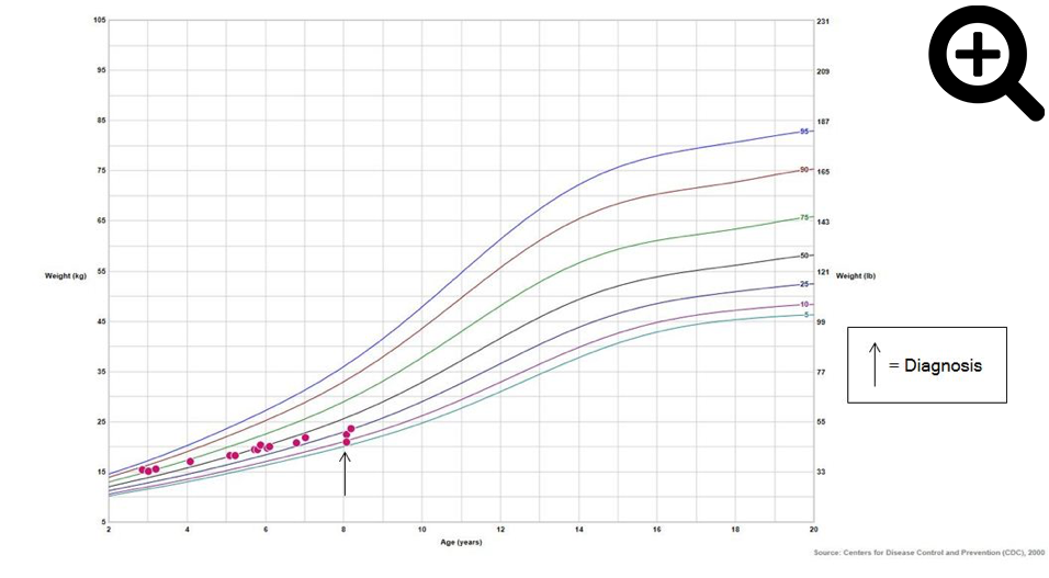 figure 2 celiac growth curve