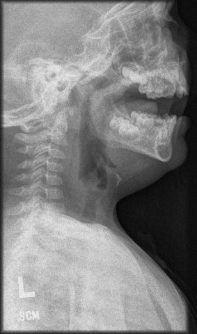 radiograph