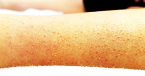 Figure 1. The patient presented with a rash on the lower extremities.