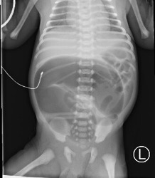 Abdominal radiography scan