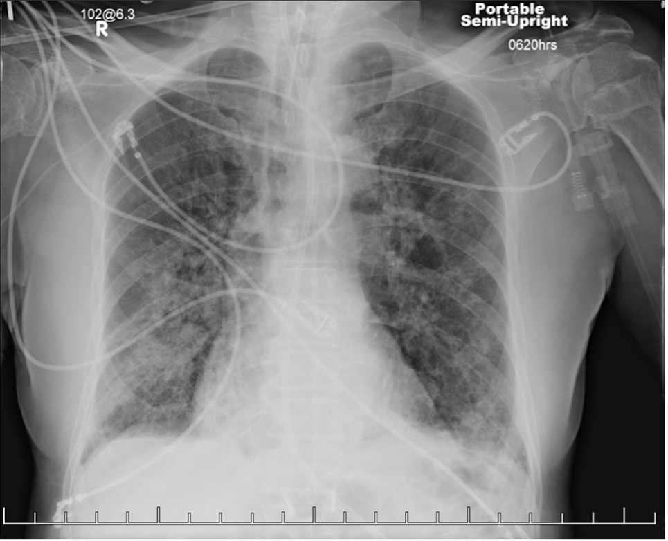 Figure 3a. Radiographs taken 1 week post-CT scan