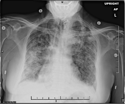 Figure 3b. Radiograph taken 2 weeks post-CT