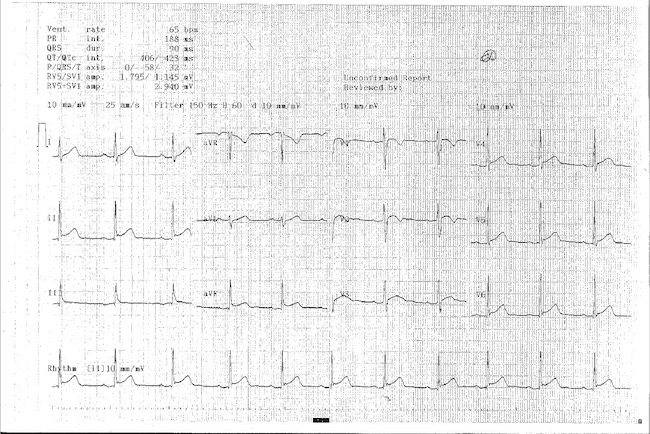 Heart chart