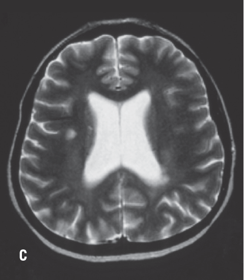 figure c