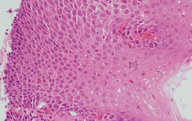 gram stain eosinophils
