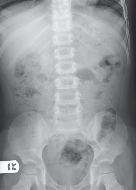 Abdominal scan
