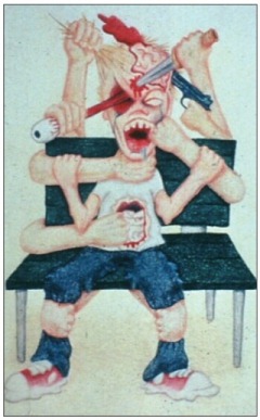 Pediatric Migraine