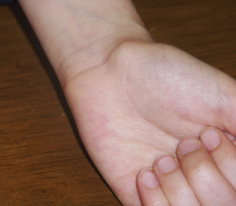 Ganglion