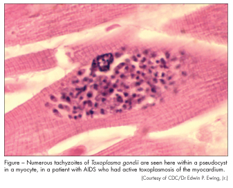 tachyzoites of toxoplasma gondii