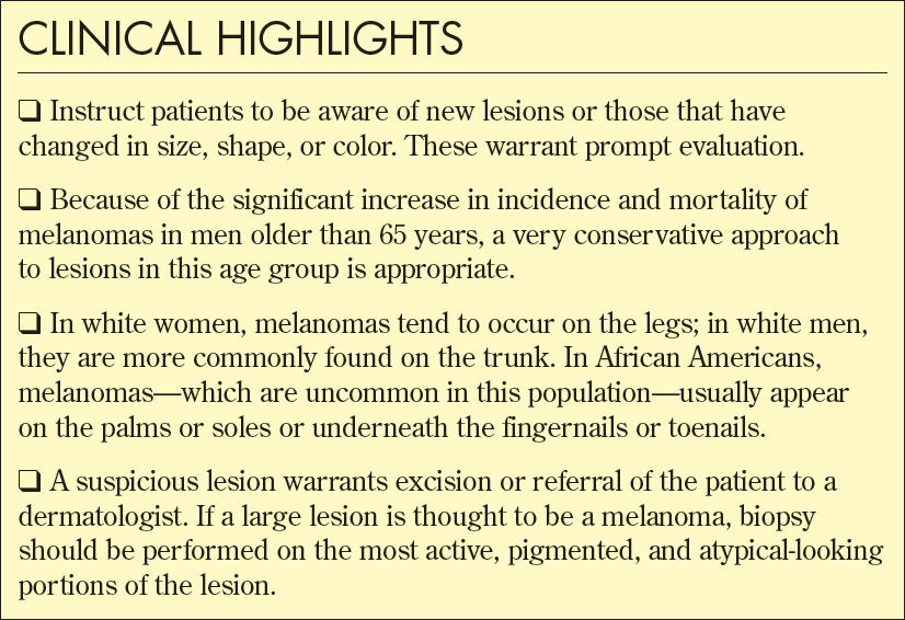 Clinical highlights for practitioners melanoma