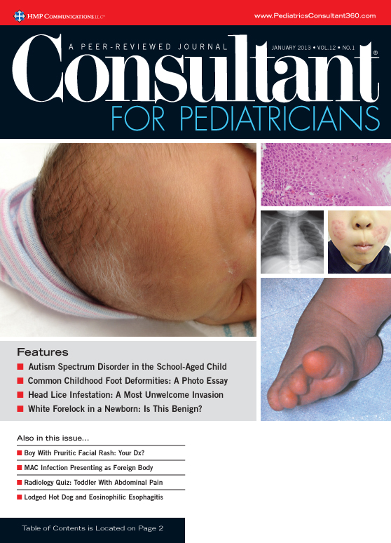 peds cover