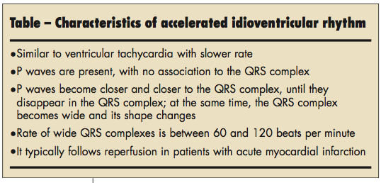 idioventricular rhythm