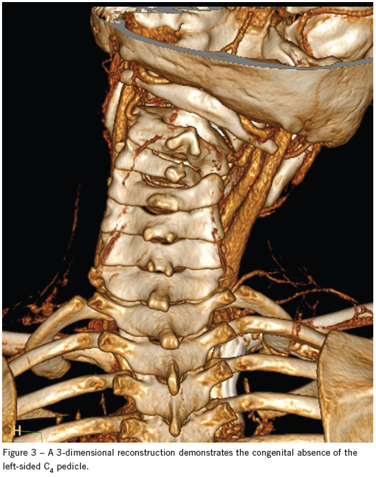 spine image