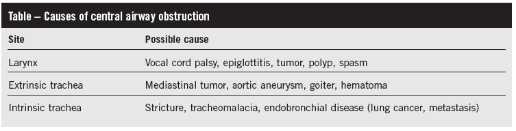 table - airway obstruction