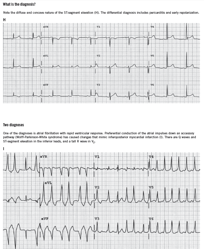 differential diagnosis