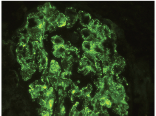 immunofluorescence stain