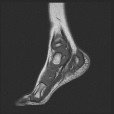 foot