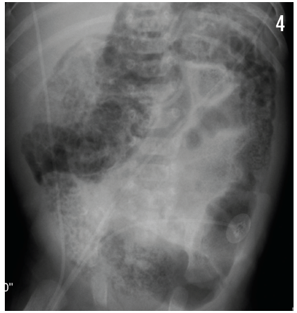 xray