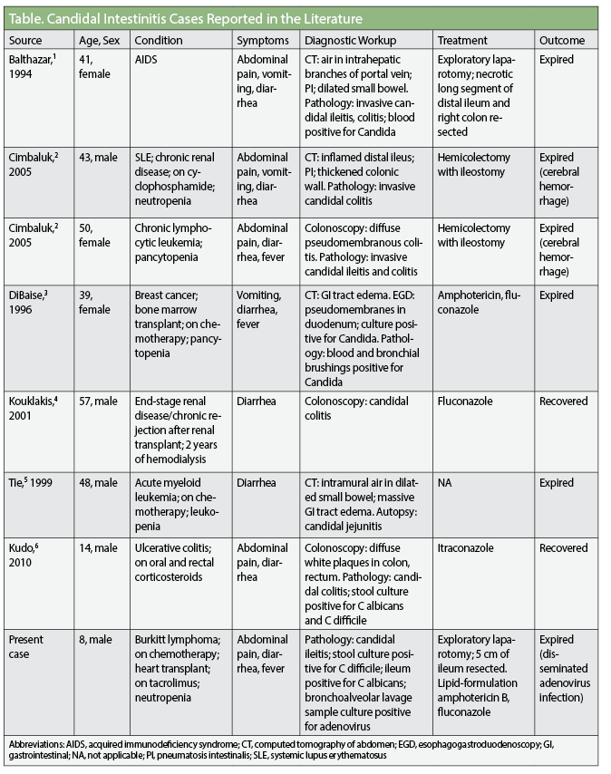table