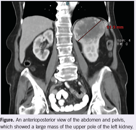 anteroposterior view of abdomen