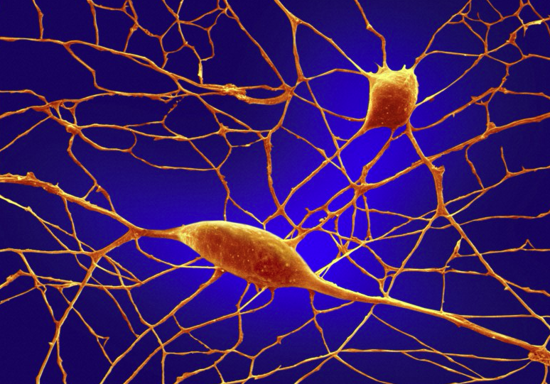 Photo credit: Credit Annie Cavanagh, Wellcome Images Photo credit: Credit Annie Cavanagh, Wellcome Images