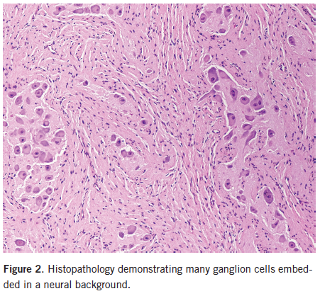 Histologic examination