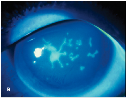 blue eye