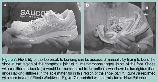 flexibility of the toe 