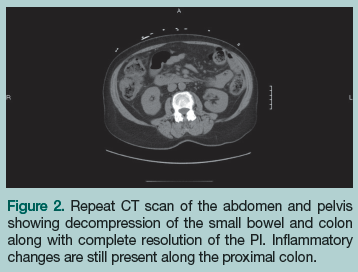 CT scan