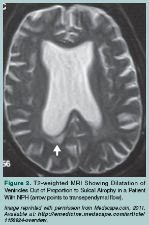 MRI