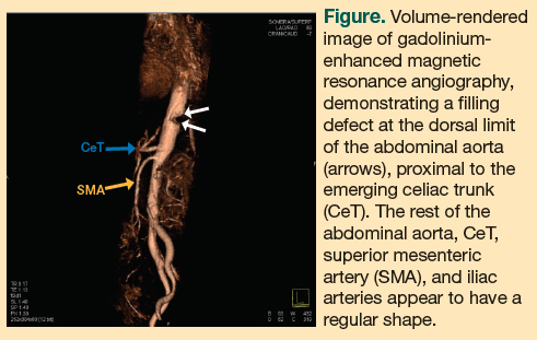 gadolinium-enhanced angiography