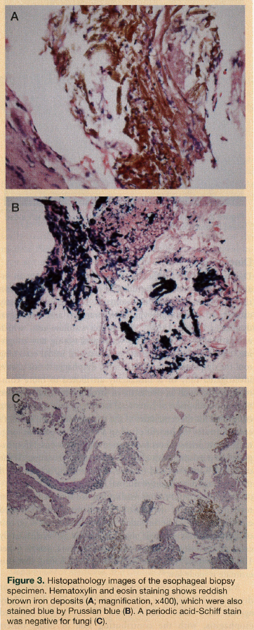 histopathology images