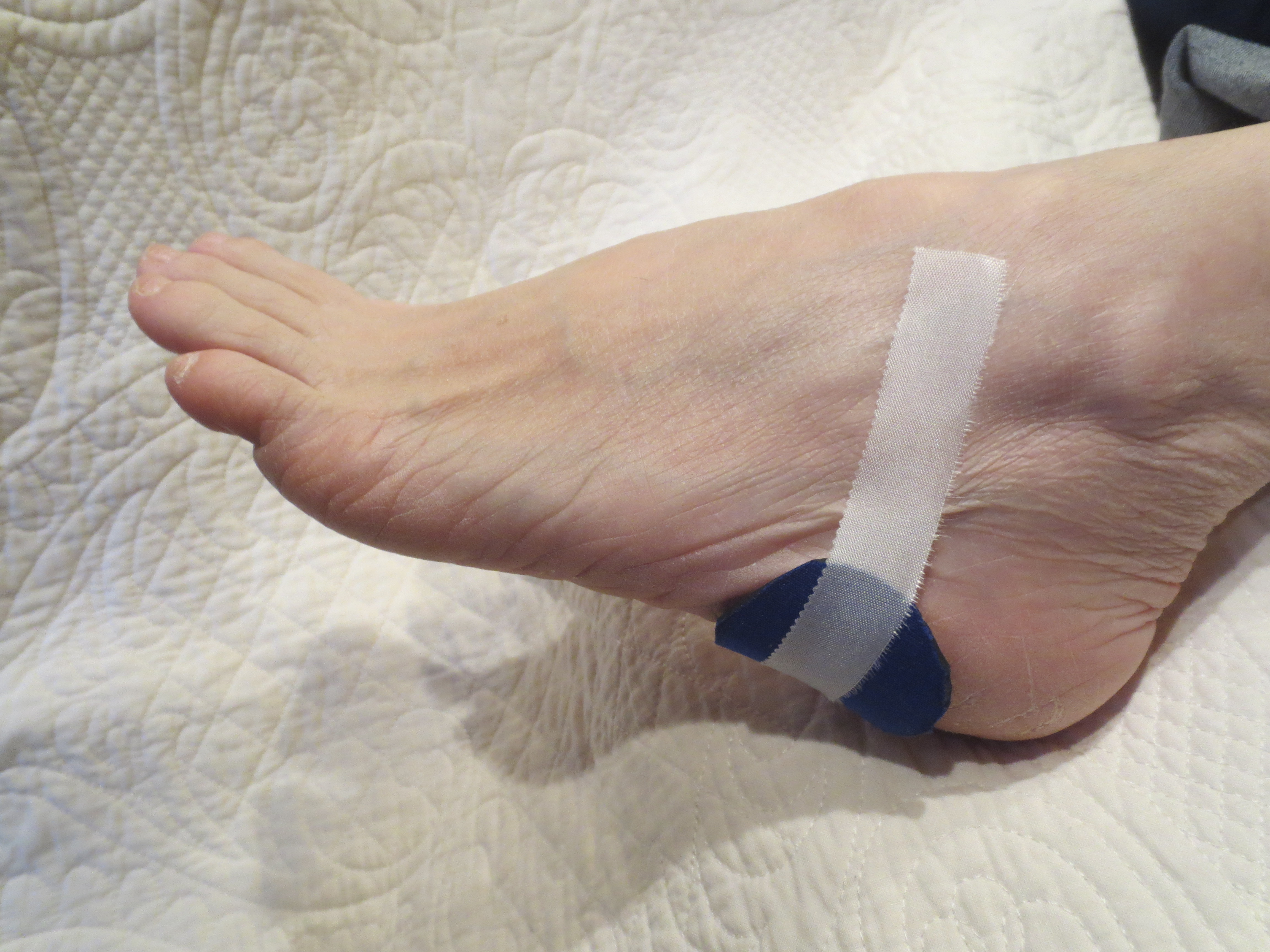 podiatrist arch support