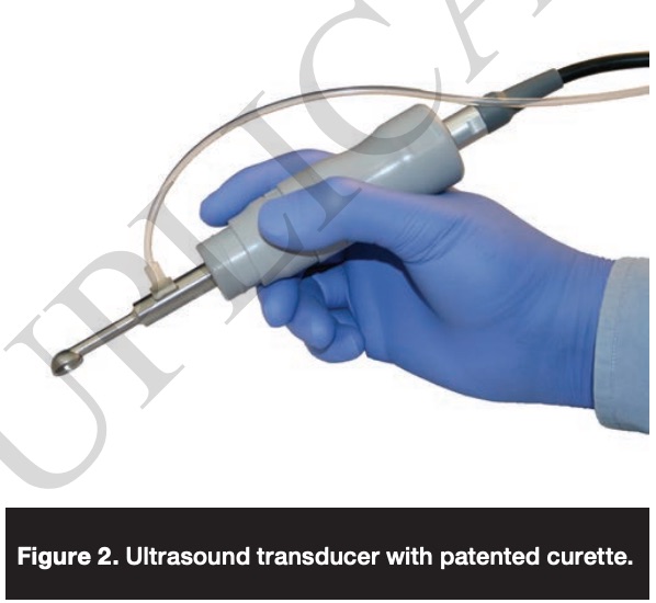 Lowfrequency Ultrasound for Patients With Lower Leg Ulcers Due to