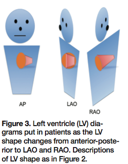 Angiographic Projections Made Simple: An Easy Guide to Understanding ...